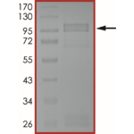 EGFR (T790M C797S), Active